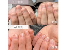 堂々と出せる手へ