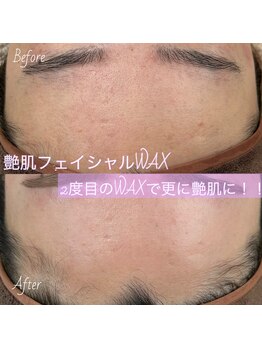 エスト(este.)/艶肌フェイシャルWAX