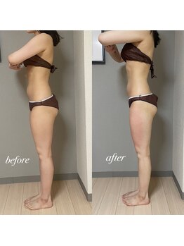 エヌボーテ(N. beaute)/before→after2回目