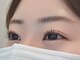 ランダ(RANDA)の写真/《ナチュラルかつ理想的なお目元へ》目元のお悩みがある方もしっかり解消します◎