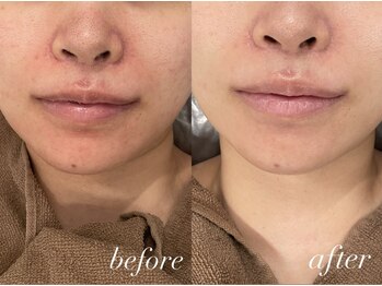 フェイン 青山店(fein.)/赤みの鎮静効果♪