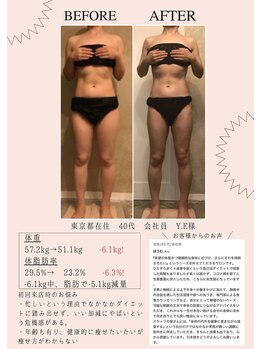 ラヴィニティ 南越谷店(Lavinity)/本格痩身を行うなら今しかない！