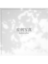 ラヴィン なんばスカイオ店(Lovin)/【症例写真】