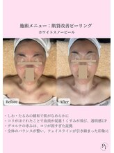 プラスワンビューティテン 新大阪店(Plus One Beauty)/フェイシャル