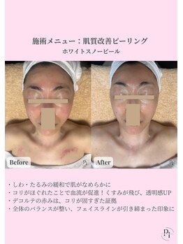 プラスワンビューティテン 新大阪店(Plus One Beauty)/フェイシャル