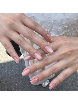 ティリット(TILLIT)/