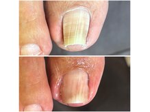 あしぁか 銀座の雰囲気（【巻き爪】当日にすぐ変化！巻き爪や陥入爪施術が得意なサロン）