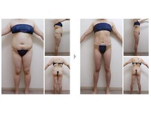 ソフィア ミューズ 目黒/エンダモロジーコラボ痩身