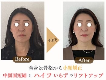 エソア(esoa)の写真/美容歴17年の熟練技!看護師が提供する小顔矯正で理想のフェイスラインへ◎