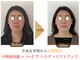 エソア(esoa)の写真/美容歴17年の熟練技!看護師が提供する小顔矯正で理想のフェイスラインへ◎