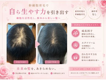 カプリ(CAPRI)の写真/幹細胞×エラスチンで根元ケア。ハリ、コシのある美しい髪へ導き育毛を促す最新育毛エステ♪◎