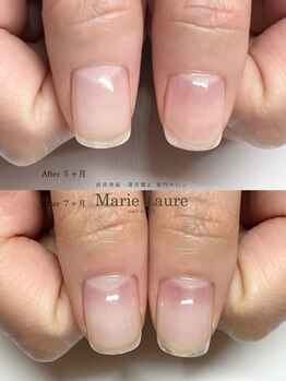 マリーロール 梅田店(Marie Laure)/自爪育成/深爪矯正/ネイルケア