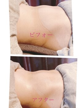 ヴァローレ(valore)/お腹ケア