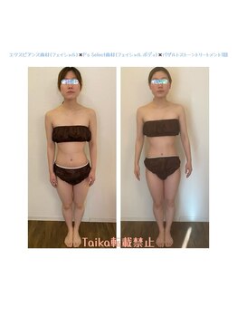 タイカ(Taika)/寝ているだけ！姿勢改善ケア