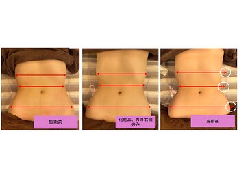 レーヴ(Reve)/ウエストラインの形成♪