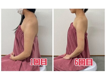 ブリランテ(Brillante)の写真