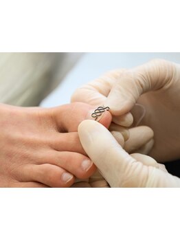 爪の悩みを解消できる（ケア含む）