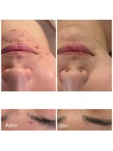 プララン 京都桂店(Plaran)/【CHRISTINA 】乳酸菌ピール