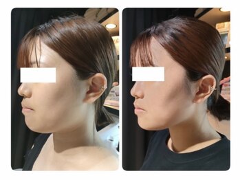 ソラ(sola*)/レモンボトル