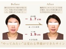 アロハ(ALOHA.)/“やりたい”は変わる準備の印