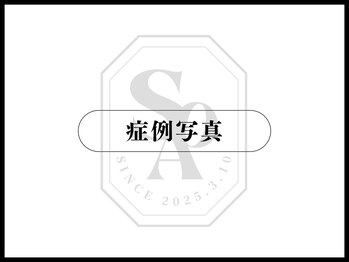 韓国肌管理室 ソア(soa)/【症例写真】