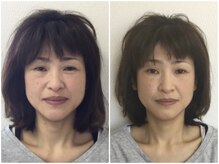 ウェリナ 一宮院/小顔矯正/骨盤矯正/痩身整体