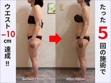 ぷりんす整体コージー(COZY)/【50代 女性】ビフォーアフター