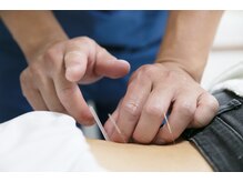 こまつ鍼灸院の雰囲気（東洋医学と西洋医学の両面からケアさせて頂きます。）