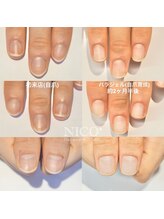 ニコプラス(NICO+)/自爪育成中