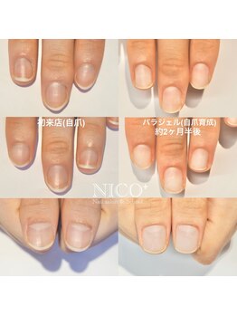 ニコプラス(NICO+)/自爪育成中