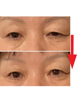 グロッシー(glossy)/ドライヘッドスパ