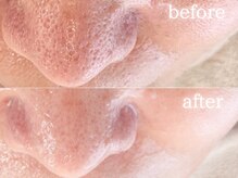 メモリ/お客様の変化/毛穴ケア