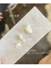 スパークル/毛穴洗浄/毛穴/ワックス/脱毛