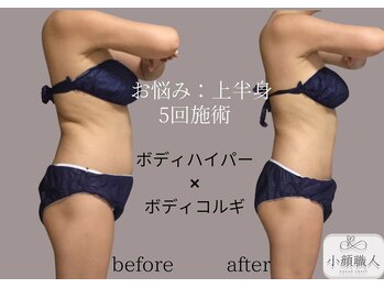小顔職人/ボディビフォーアフター/40代