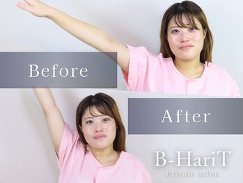 ビーハリット(B-HariT)/Before/After【六本木】