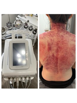 エミール(EMIIR)/慢性的な疲れ身体のコリに