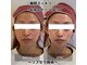 サンサンゴビューティー(335beauty)の写真