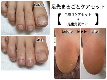 リミュレット(Lymulet)の写真/角質ケアで自信あふれる足元へ!素足になる準備は万端ですか?セルフ派の方もケアはプロにお任せを!