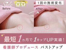 シエル(Siele)
