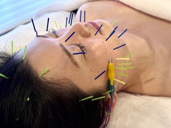 和美躰の写真/【フェイスラインのもたつきやむくみ・エラ張りが気になる方に！】お顔の悩みを身体から見る小顔美容鍼☆
