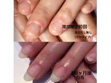 リノール(Linol)