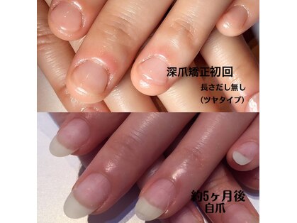 リノール(Linol)の写真