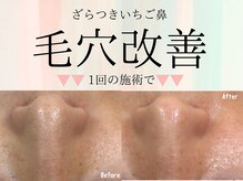 パールプラス 臼杵店
