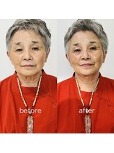 アイジー(iG)/70代後半女性