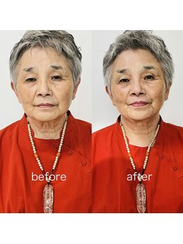 アイジー(iG)/70代後半女性