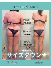 スリムライク 鳥取店(The SLIM LIKE)/痩身ビフォーアフター