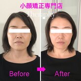 小顔矯正サロン セラフィ
