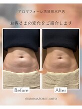 アロマフォーレ 水戸店(AromaForet)/肩・腰・脚整える全身マッサージ