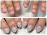 【全員】ハンド深爪矯正メニュー単発