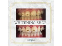 ホワイトニングショップ 尼崎店の雰囲気（矯正中でもホワイトニング可能♪虫歯があっても問題ありません！）